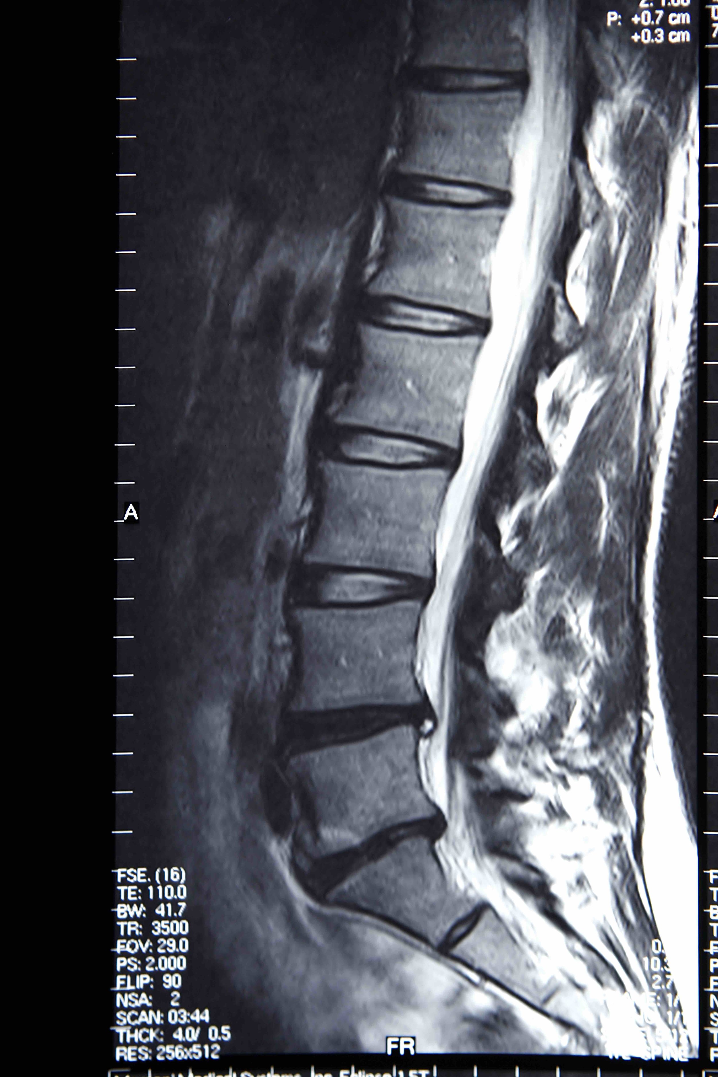 mri.jpg