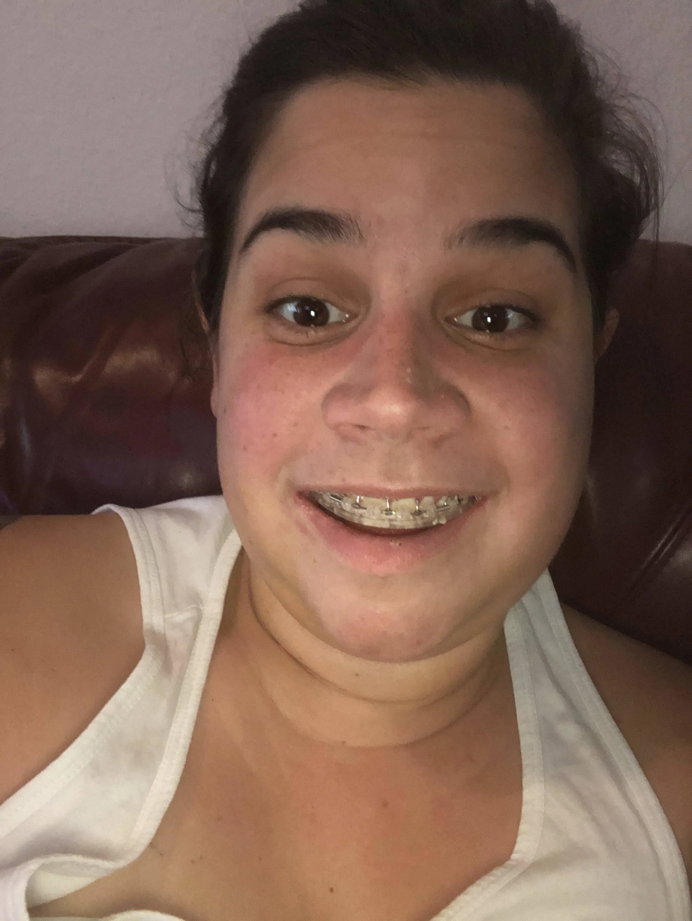 First time I could really smile!