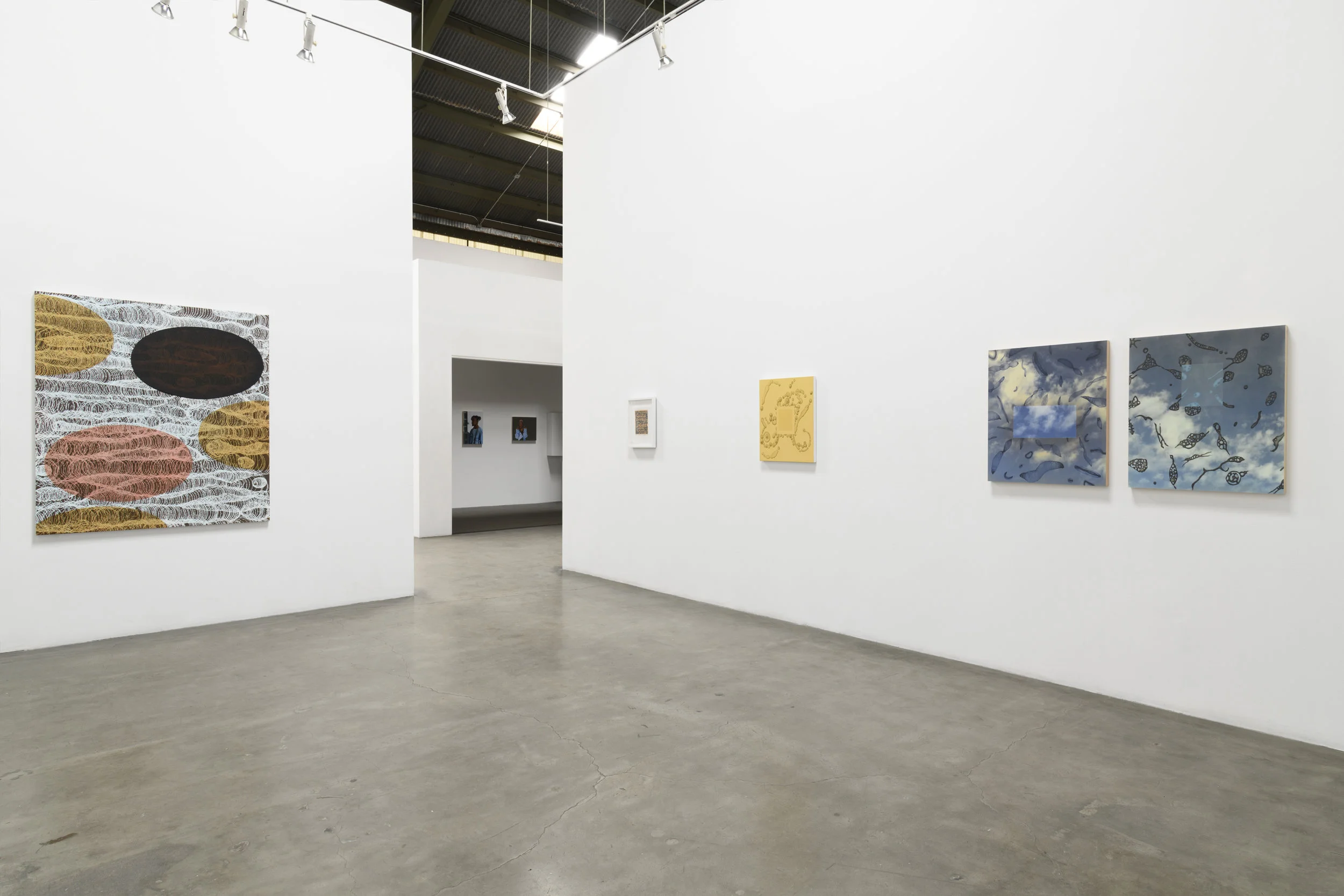 Exhibition view