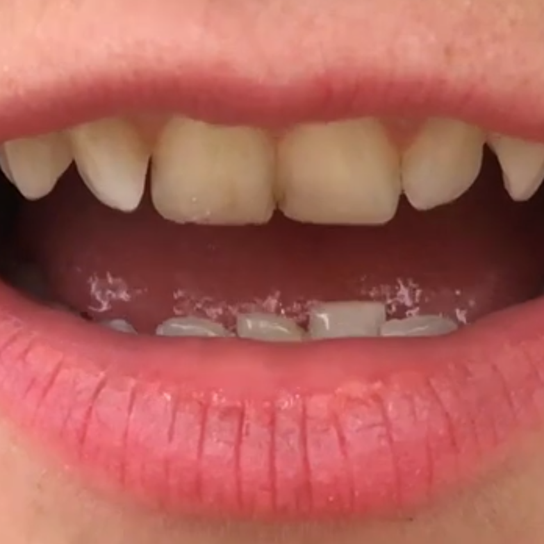 Week 51 - Acevedo & Thornton