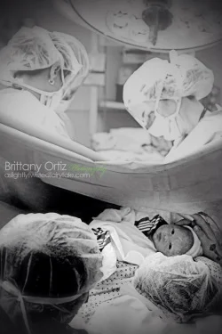 Doula supported cesarean. Photos by Brittany Ortiz