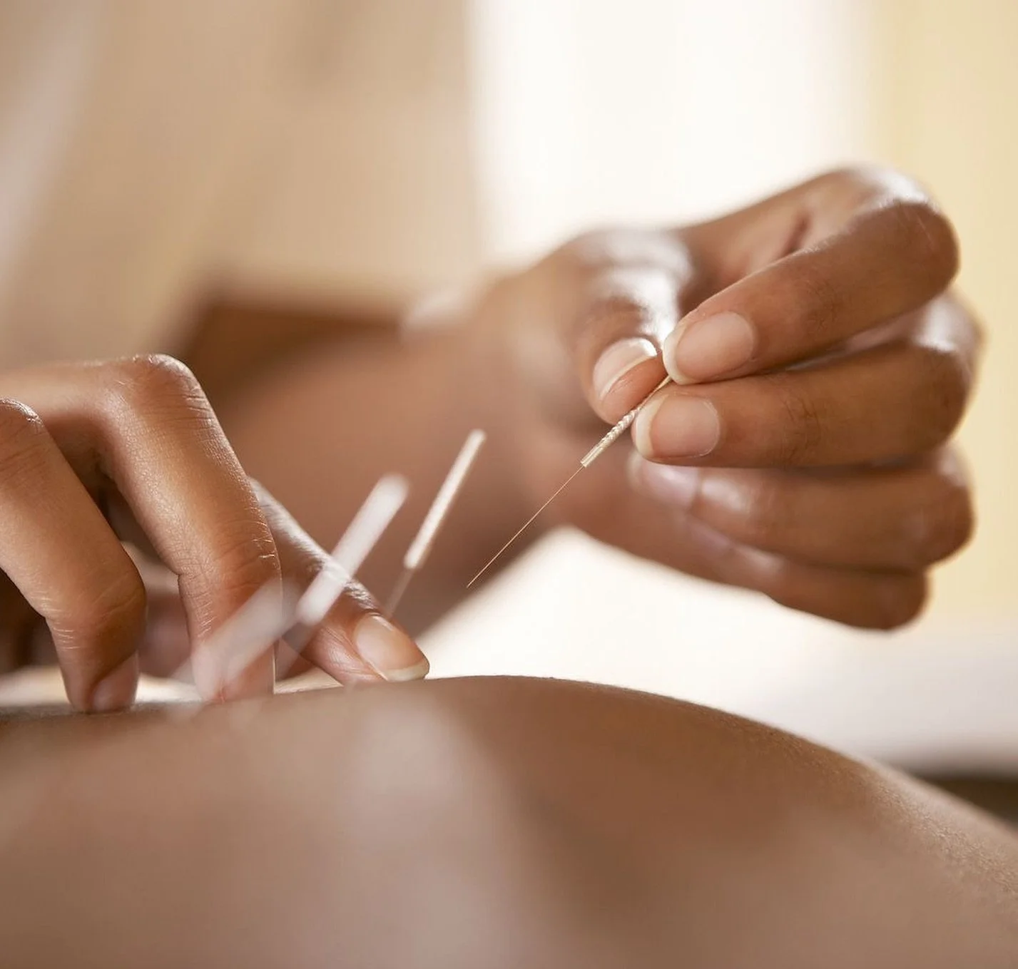 Are you looking for treatment that aims to address the root cause of your health concern, is increasingly proven to be effective, and is provided by therapists you can trust and who genuinely listen to you?
Our four AHPRA registered Chinese Medicine