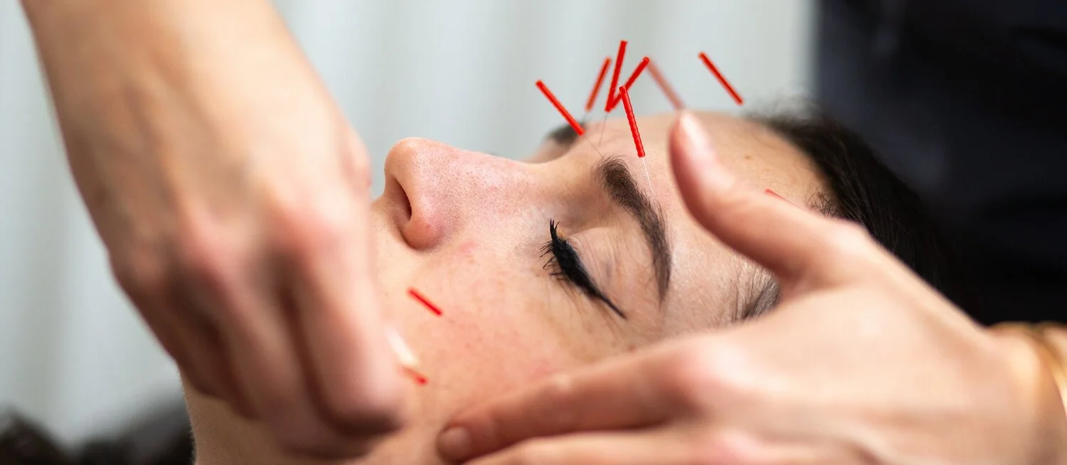 acupuncture-beauty-facial-skincare.jpeg
