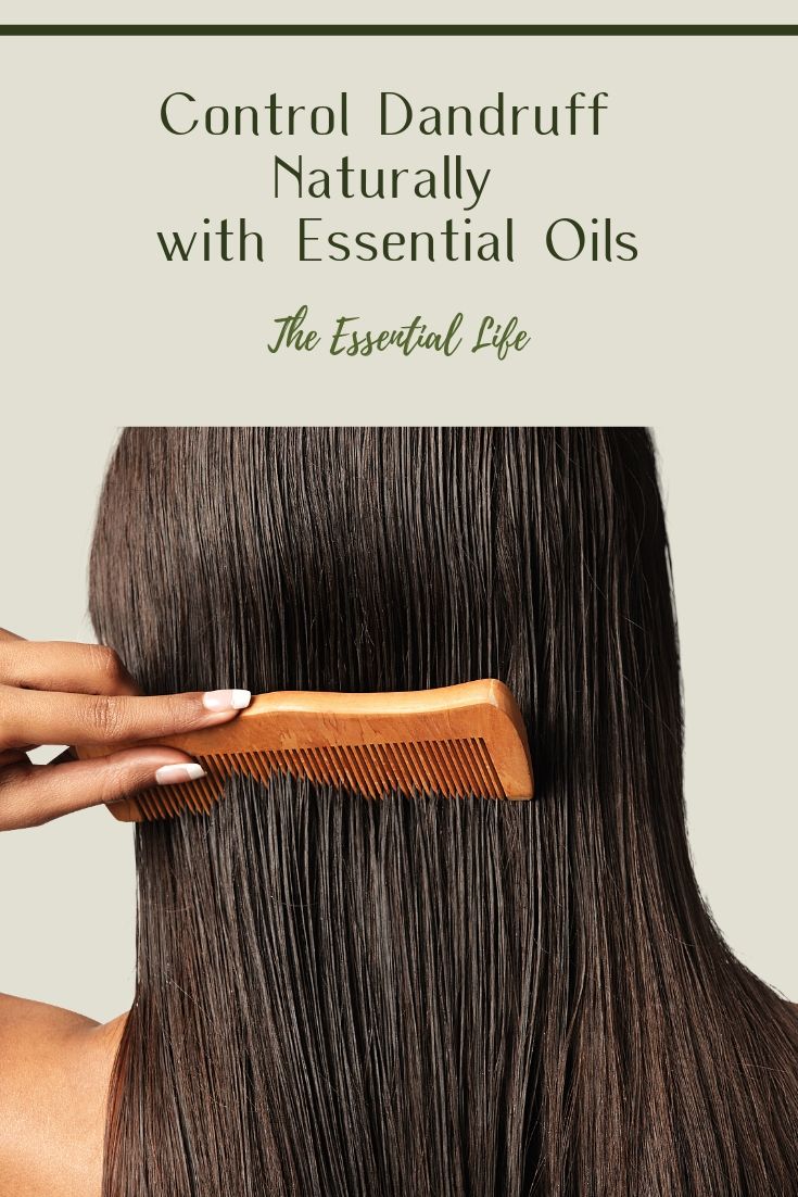 Control Dandruff Naturally with Essential Oils_ The Essential Life.jpg