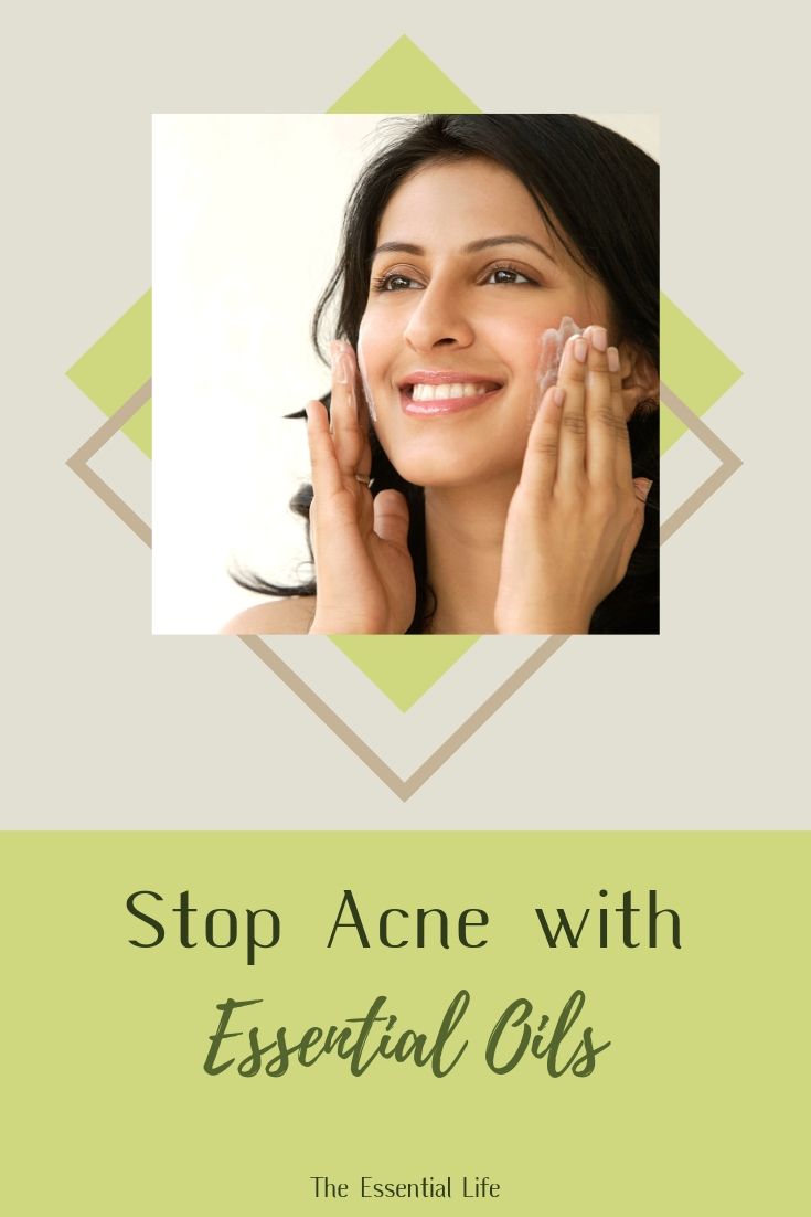 Stop Acne with Essential Oils_ The Essential Life.jpg