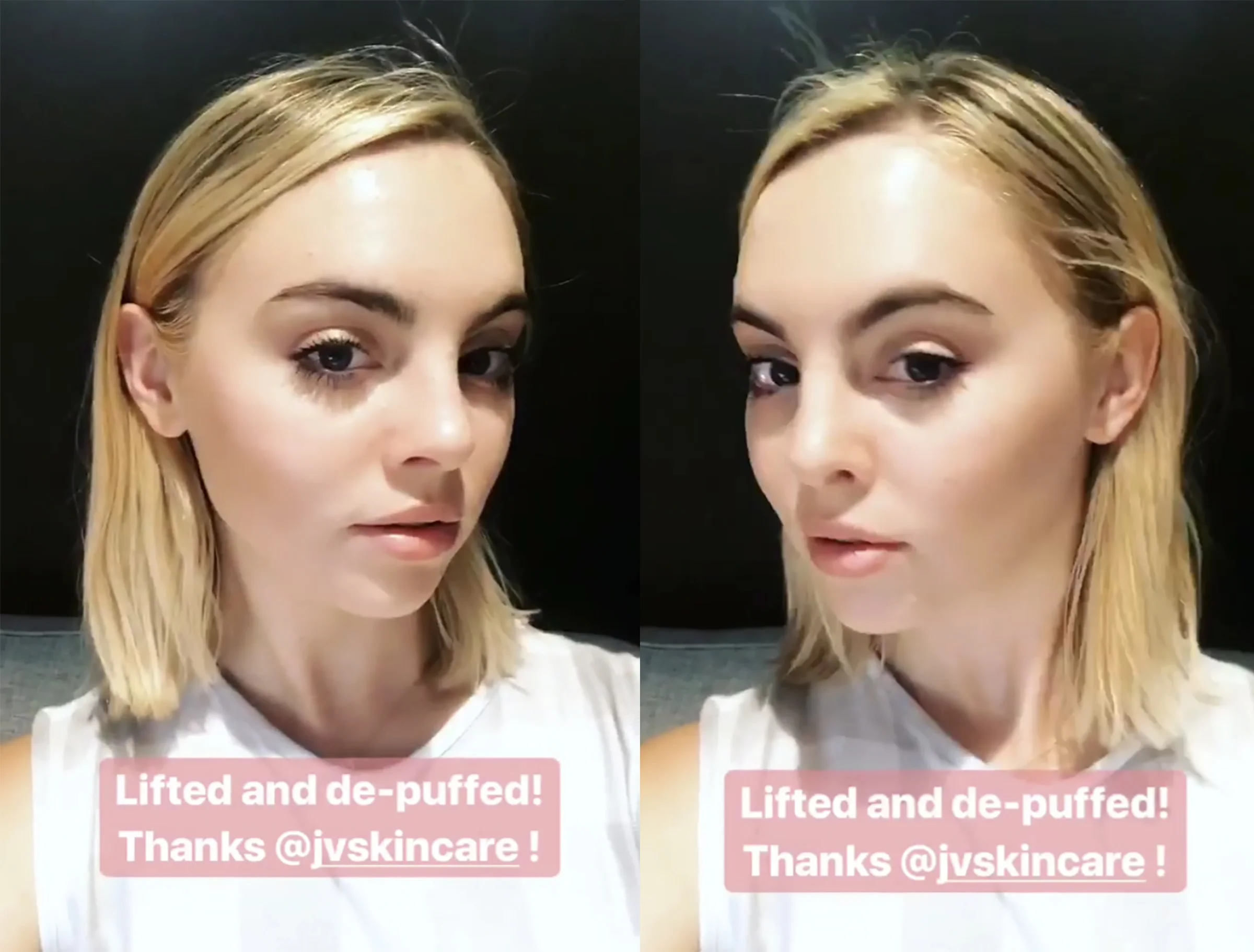 before and after.jpg