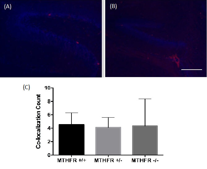 Figure 2. Combined images of the co-localization of PH3 and DAPI immunofluorescence staining in the dentate gyrus of a (A) wild-type MTHFR mouse (+/+) and (B) homozygous knockout MTHFR mouse (-/-). 200X magnification. Scale bar 50µm. Mean co-localization count in the dentate gyrus of MTHFR knockout mice and controls (C). No statistically significant differences were viewed ( F (2,8) = 0.03, p = 0.974). Standard deviations are represented by the standard deviation bars attached to each column.