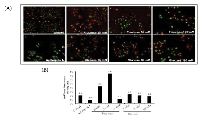 Figure 3: Mitochondrial permeability. J774A1 cells were treated with increased concentrations, 25mM, 50mM and 100mM, of fructose or glucose for 24h, and then incubated with JC-1 dye for 15 minutes. The pictures (Figure 3a) of live cells were taken using the Olympus BX53 fluorescence microscope at 540/570 nm (red) for healthy cells and 485/535 nm (green) for unhealthy cells. An increase in red/green fluorescence intensity indicates healthy or hyperpolarized mitochondria, illustrated on the graph on the bottom (Figure 3b) . The red/green ratio was calculated using integrated intensity of red and green channels measured by ImageJ software.