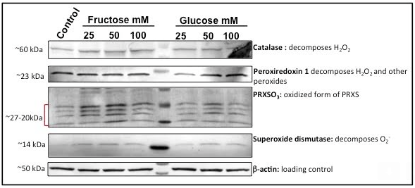 Figure 4: Antioxidant enzymes. J774A1 cells were treated with fructose or glucose at 25mM, 50mM and 100mM for 24h after which they were lysed using lysis buffer. Total amount of antioxidant enzymes, catalase (60KDa), peroxiredoxin 1 (PRX1, 23KDa), the oxidized from of peroxiredoxins (PRXSO3) ranging from 27-20KDa and superoxide dismutase 1 (SOD1, 14KDa), were analyzed by western blotting. β-actin (50KDa) was used as loading control for total protein content.