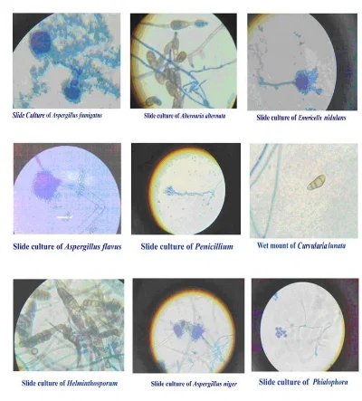 Figure 2. Figure 2 shows the morphology of spores of (A) Aspergillus fumigatus, (B) Alternaria alternata, (C) Emericella nidulans, (D) Aspergillus flavus, (E) Penicillium, (F) Curvularia lunata, (G) Helminthosporum, (H) Aspergillus niger, (I) Phialophora isolated from indoor environment of buildings (40X objective)