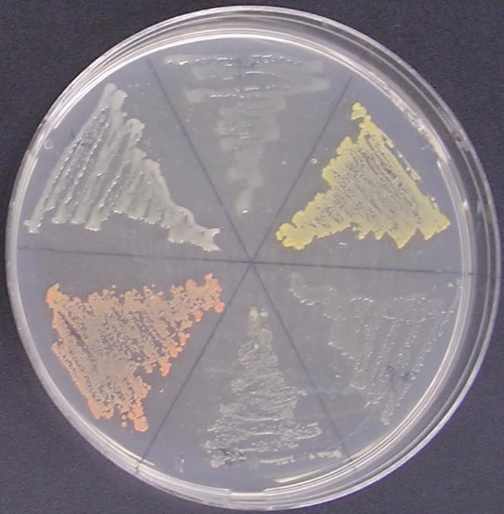 Figure 1. Media plate inoculated with six isolates displaying varying coloration, including opaque white to grey, orange-yellow and pink.