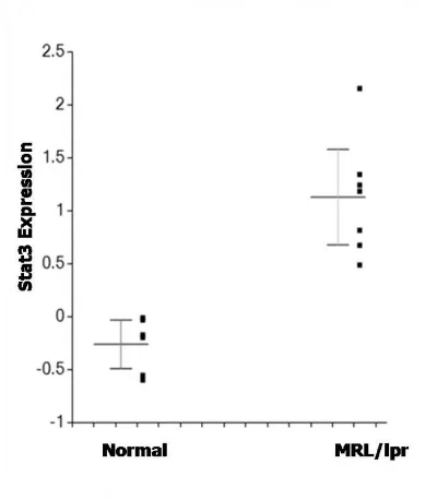 Figure 7. Elevated expression of signal transduction and activator of transcription 3 (Stat3) in lacrimal gland cells of MRL/lpr mice as compared to normal mice. Gene expression is expressed as log2 compared to reference standard. The difference in levels of Stat3 expression is significant (p=0.0005).