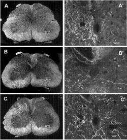 Figure 2. Corticospinal tract (CST) sprouting across the midline in the spinal cord after adenoviral vector neurotrophin 3 (Adv.EF -NT3) transduction of motoneurons. Dark-field photomicrographs of spinal cord cross sections showed the unlesioned CST axons. (A) Section from a normal rat (sham surgery). (B) Section from an Adv.EF -LacZ-treated rat (control vector). (C) Section from an Adv.EF -NT3-treated rat. CST neurites can be seen arising from the intact CST, traversing the midline, and growing into the grey matter of the lesioned side of the spinal cord. (A'-C') Higher-power photomicrographs of the regions around the central canal (Zhou et al. 2003).
