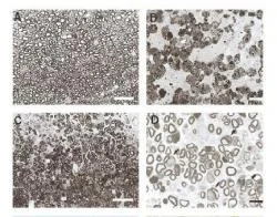 Figure 3. Remyelination of the rat spinal cord following transplantation of adult human precursor cells. Normal (A), demyelinated (B), and remyelinated axons (C) of the dorsal column. (D) Remyelinated axons at higher magnification. The anatomical pattern of myelination was similar to that produced by Schwann cells (arrows). (bar: AC, 25 µm; D, 10 µm) (Akiyama et al. 2001).