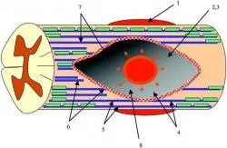 Figure 4. Schematic diagram of a piece of spinal cord that has sustained an initial injury (black central oval) that spreads progressively outward and radially (red circular region followed by orange circular region) in zones until it finally reaches the final lesion size (grey shaded area). Blue lines are axons, and green rectangles are the myelinating oligodendrocytes. Methods of intervention: 1) reduction of edema and free radical production, 2) rescue of neural tissue at risk of dying in secondary processes such as abnormally high extracellular glutamate concentrations, 3) control of inflammation, 4) rescue of neuronal/glial populations at risk of continued apoptosis, 5) repair of demyelination and conduction deficits, 6) promotion of neurite growth through improved extracellular environment, 7) cell replacement therapies, 8) efforts to bridge the gap with transplantation approaches, 9) efforts to retrain and relearn motor tasks, 10) restoration of lost function by electrical stimulation, and 11) relief of chronic pain syndromes (Hulsebosch 2002).
