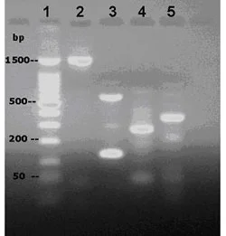 Figure 2. PCR amplification of S. tenjimariensis DNA using designed primers. Lanes: 1, 100 bp DNA ladder; 2, DOI; 3, AMT; 4, Alpha amylase; 5, 16S rDNA.