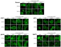 Figure 1. α-Synuclein Localization in Oxidative Stress and Mitochondrial Mutants; Images captured of budding yeast at 24 and 48 hours of α-synuclein expression are shown at 1000x. Here, α-synuclein is tagged to green fluorescent protein (GFP) on the carboxyl-terminus, which allows for analysis of its localization when illuminated at 488 nm. Along with wild-type (WT) α-synuclein, localization of two α-synuclein familial mutants, A30P and A53T, are also shown. All strains show plasma membrane localization of α-synuclein at 24 and 48 hours of induction as described in Sharma et al. (2006). However, only kgd1∆ cells display intracellular aggregates at 24 hours and aggregates near the plasma membrane at 48 hours of α-synuclein expression.