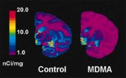 SERT (serotonin neuron) density measured by PET scan in baboon brains. The baboon on the right was given a neurotoxic dose of MDMA a year before the scan; the control baboon was given a placebo. Image courtesy: DEA