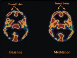 From "Studies of Advanced Stages of Meditation in the Tibetan Buddhist and Vedic Traditions. I: A Comparison of General Changes" Alex Hankey