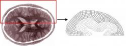 Fig 2: Diagram of the biological geometry used to create the computational mesh. One hemisphere of a horizontal brain slice was broken down into the domains of the ventricle, white matter, gray matter, and SAS.