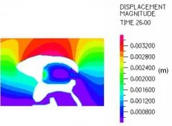 Fig. 12: Displacement magnitude during systole surrounding the lateral and 3rd ventricles. The maximum displacement of more than 3.4 mm occurred on the upper surface of the ventricular wall as it was compressed downward by the expanding parenchyma.