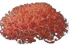 Figure 1. Brain vasculature of the human brain.