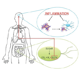 A New Perspective on Parkinson’s Disease: Pathology Begins in the Gastrointestinal Tract