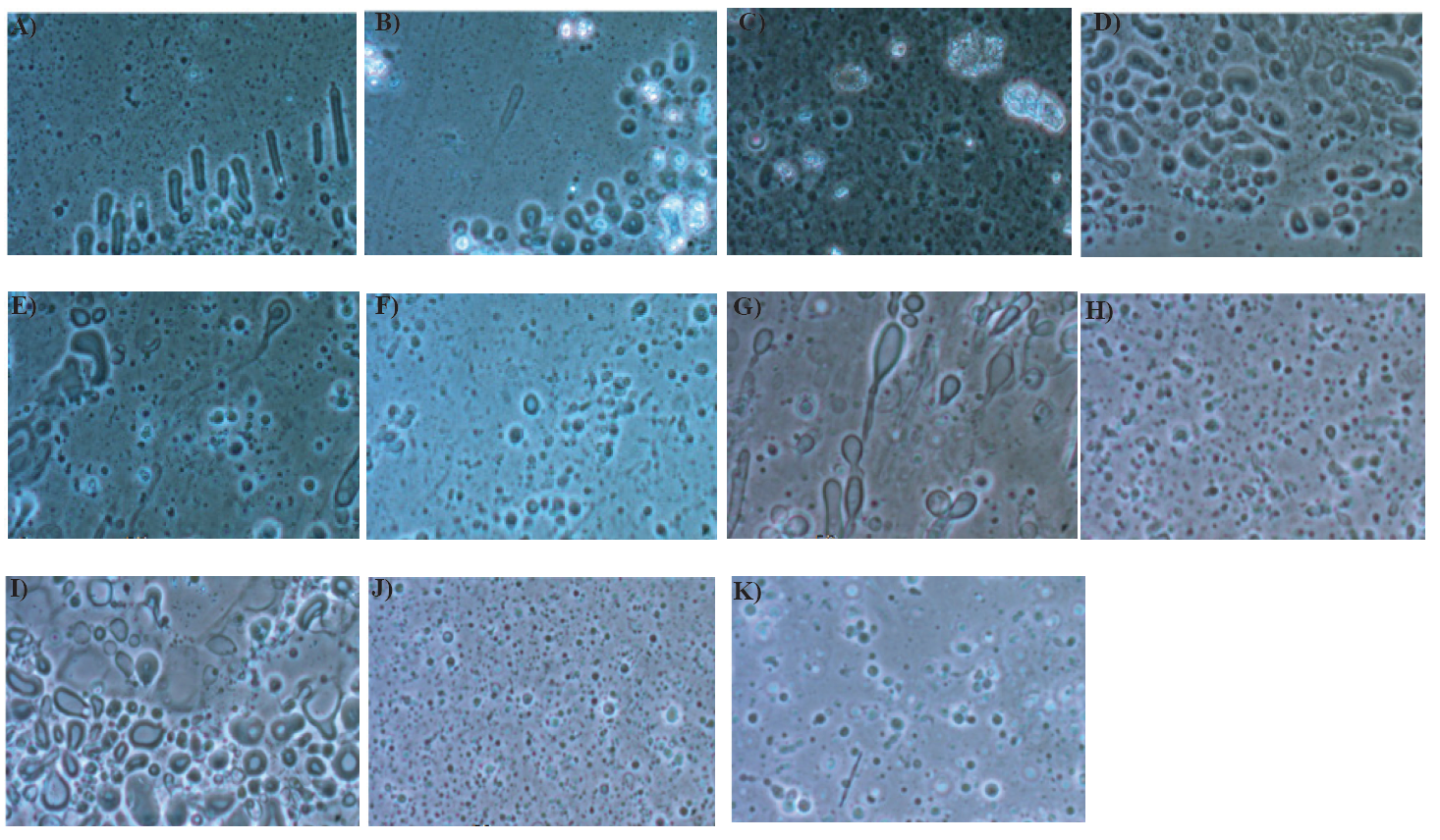 Figures 6A-F. Microscopy of fluorescence-labeled liposomes. A) 5:1 polyglycine to labeled phosphatidyl glycerol. B) 10:1 polyglycine to labeled phosphatidyl glycerol. C) 10:1 polyglycine to unlabeled phosphatidyl glycerol. D) Labeled phosphatidyl glycerol in 1 mM sucrose. E) Unlabeled phosphatidyl glycerol in 1 mM glycine. F) Unlabeled phosphatidyl glycerol in 100 mM sucrose. Figures 6G-K. Determination of osmotic lysis prevention. G) 0.5 mL phosphatidyl glycerol with 0.5 mL pyranine. H) 1:1 phosphatidyl glycerol to polyglycine (0.5 mg/mL solution. 25) 1:1 phosphatidyl glycerol to polyglycine (2 mg/mL) solution. 26) 1:1 phosphatidyl glycerol to polyglutamate (0.5 mg/mL) solution. 27) 1:1 phosphatidyl glycerol to polyglutamate (2 mg/mL) solution.