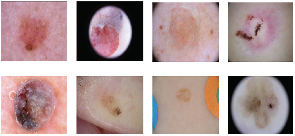 Figure 1. Eight images showcasing the variety of ISIC16 dataset.