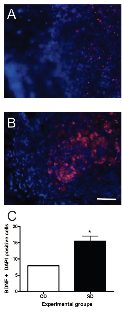 Figure 1. The impact of supplemental diet (SD) after ischemic damage on brain-derived neurotrophic factor (BDNF). Representative images of brain tissue stained with BDNF (red) and DAPI (blue) at the damage site from CD (A) and SD (B) mice. Quantification of BDNF and DAPI positive cells within the damage site (C). * indicates a p < 0.05. All pictures at 400X magnification, scale bar = 50 µm.