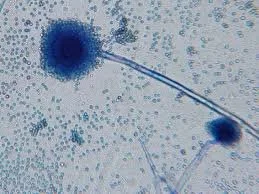 In the Search for Cancer Treatments, a Familiar Fungus Gets Modern
