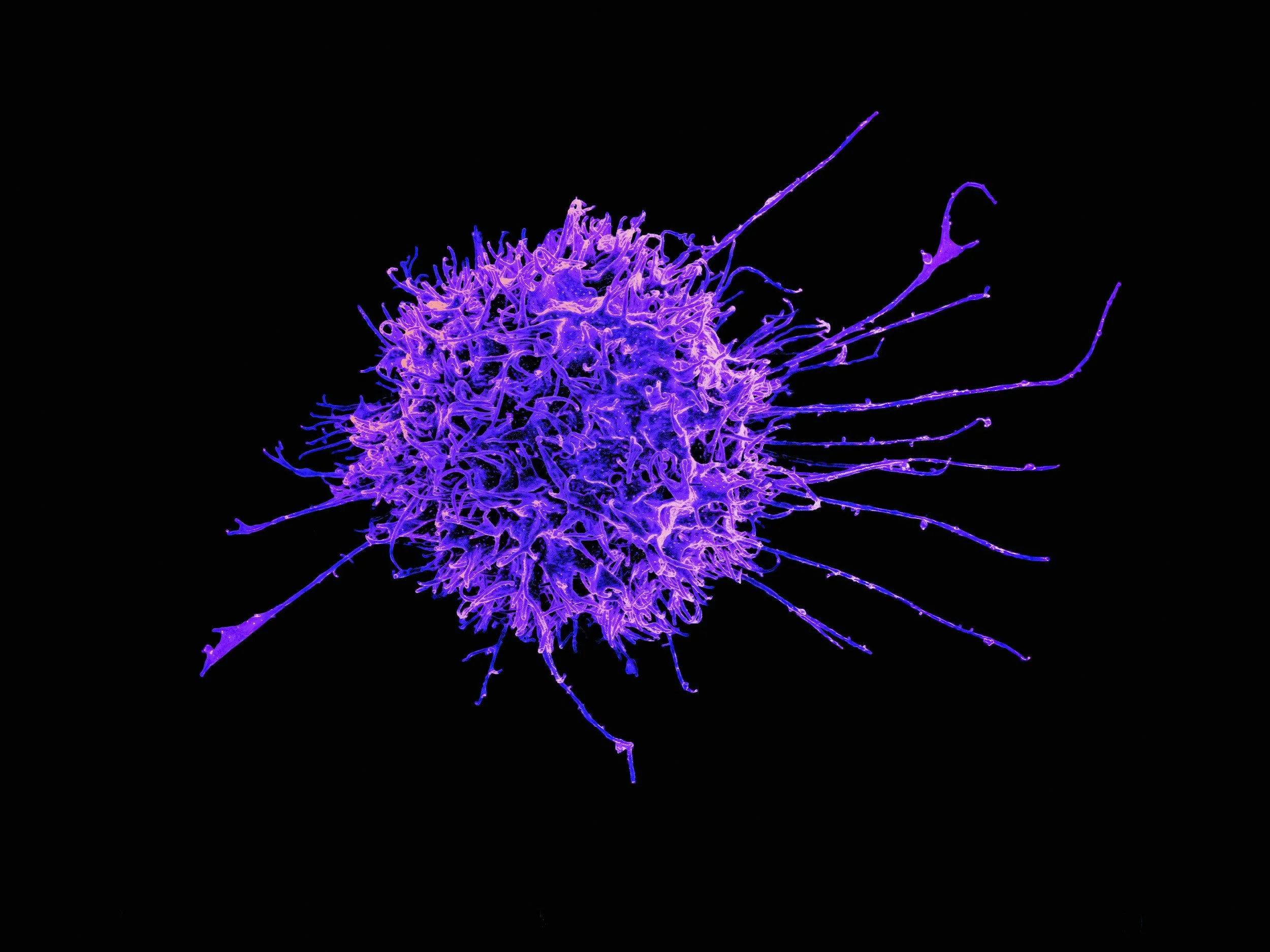 Could CAR-T therapy reset the immune system?