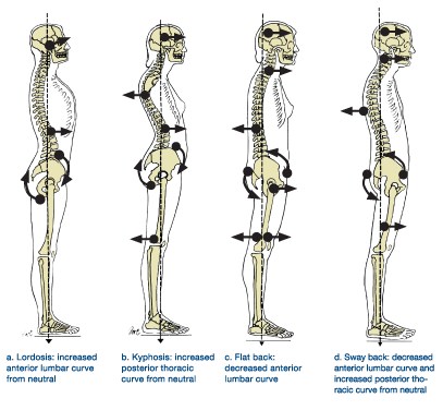 Rib cage position - yes it's important! — Align Fitness Pilates