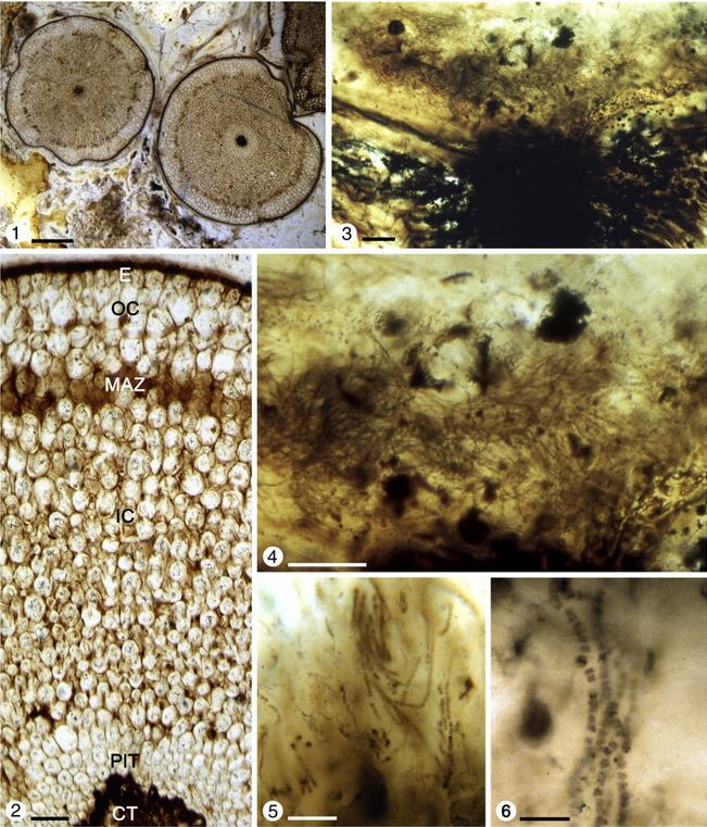 1. Transverse section through two typical axes showing the simple internal organization; slide P1828; bar = 1 mm. 2. Anatomy of the prostrate mycorrhizal axis (E = epidermis; OC = outer cortex; MAZ = mycorrhizal arbuscule-zone; IC = inner cortex; PIT = phloem-like tissue; CT = conducting tissue); slide P1612; bar = 150 μm. 3. Dense aggregate of cyanobacterial filaments in an area where the axis is injured and has exuded some type of wound secretion (opaque mass); slide P1289; bar = 100 μm. 4. Detail of Plate I, 3, showing part of the cyanobacterial aggregate; bar = 100 μm. 5. Intercellular cyanobacterial filaments near the mycorrhizal arbuscule-zone of the cortex (darker tissue in lower third of image); slide P3652; bar = 50 μm. 6. Group of filaments passing through the intercellular system of the outer cortex; slide P3652; bar = 20 μm.