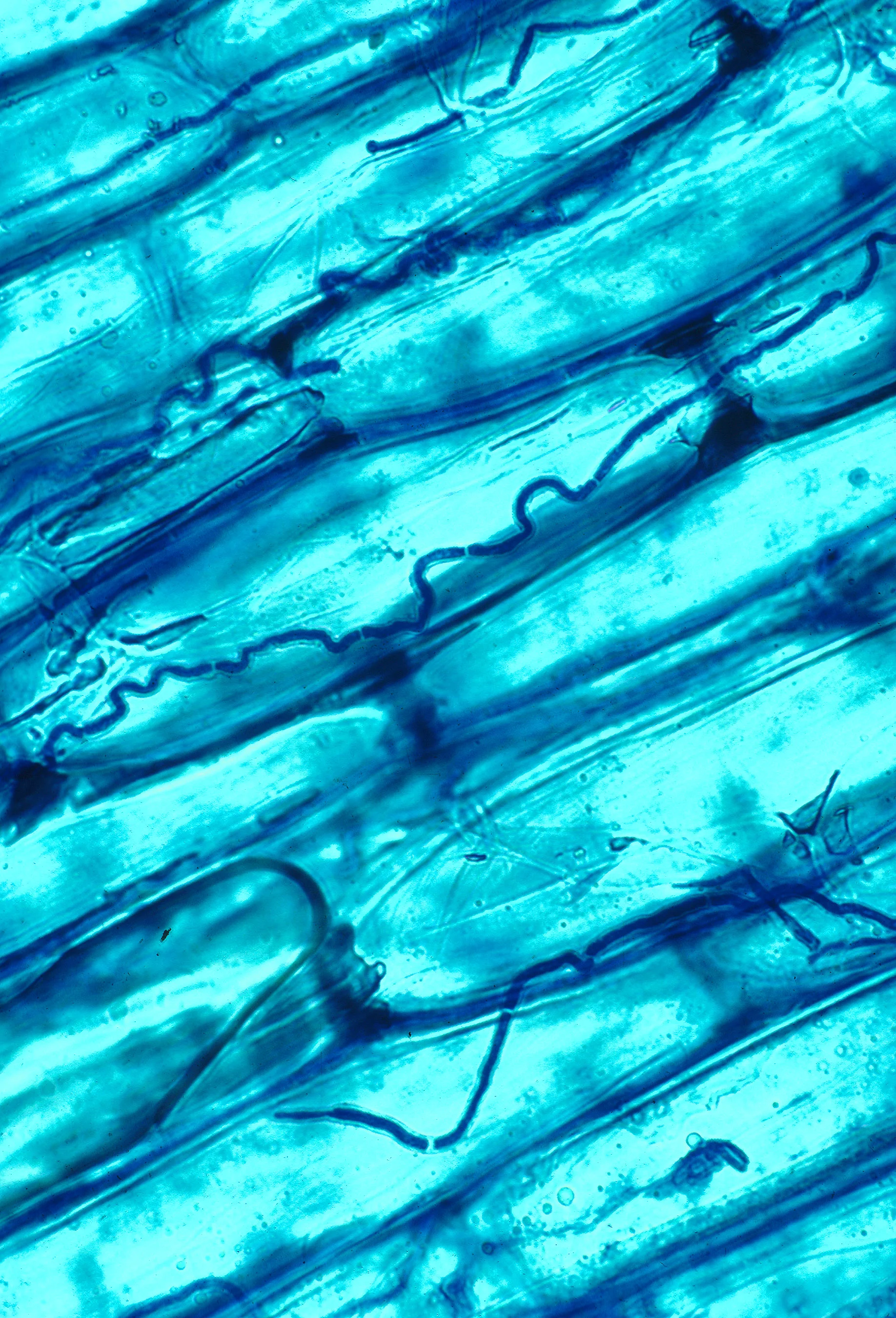 Endophytic fungi living in the cells of a grass leaf.
