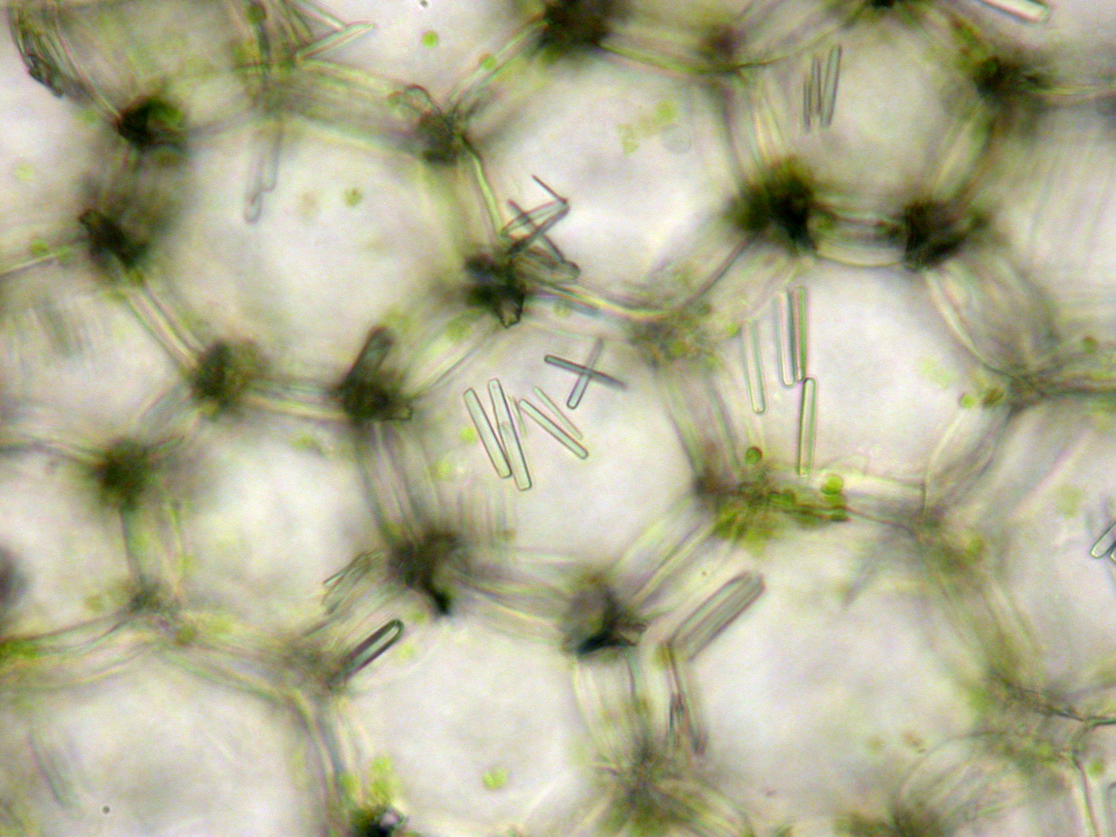 Cigar-shaped raphides found in the tissues of the polka dot plant ( Hypoestes phyllostachya ).