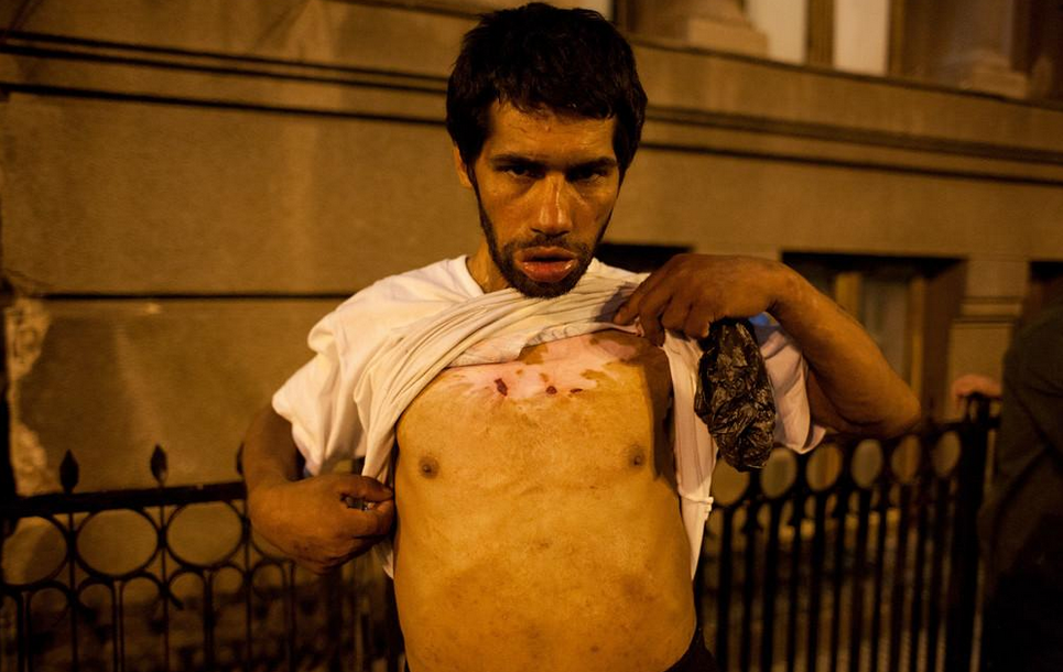 Bucharest's Drug-Addicted Roma Are Being Left to Rot