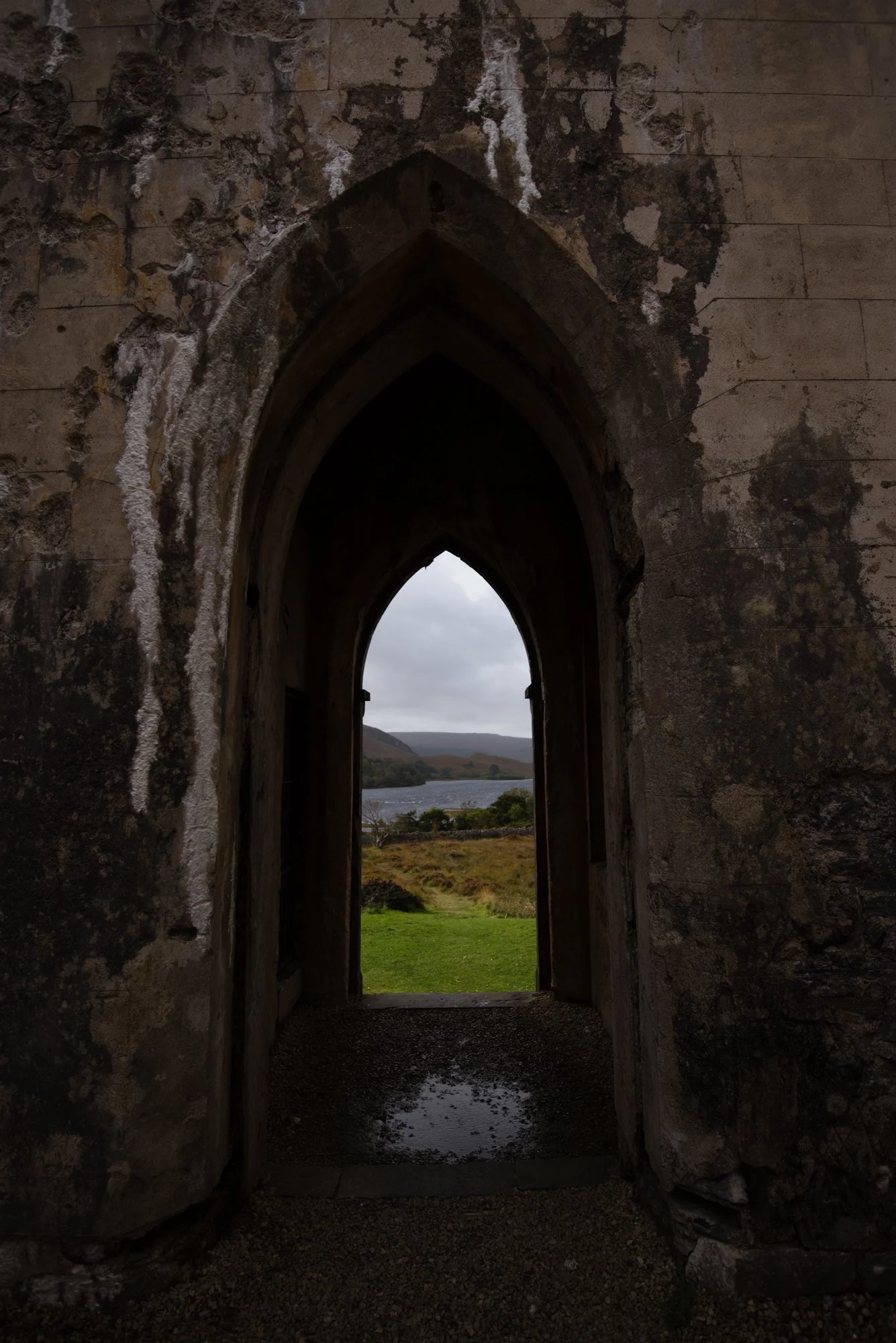 hypoplastic left heart syndrome