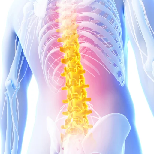 McKenzie Method and Therapy