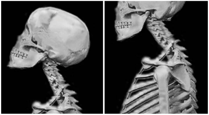 Figure 4: In a surprising finding, participants who fared poorly on Go/No-Go also tended to hold their heads habitually in an extended position (left). Participants who did poorly on Stroop had habitual forward head posture (right). Why this difference? Does struggling with different kinds of inhibition manifest differently in posture and movement?