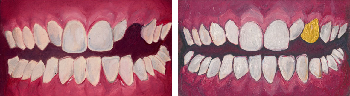 Before & After #3 , 2017 oil on board 4 x 7 inches (each piece)