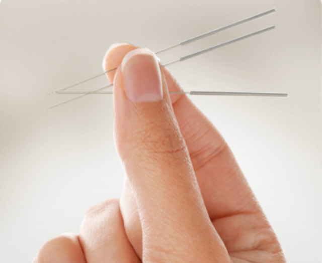 Dry Needling is NOT Acupuncture