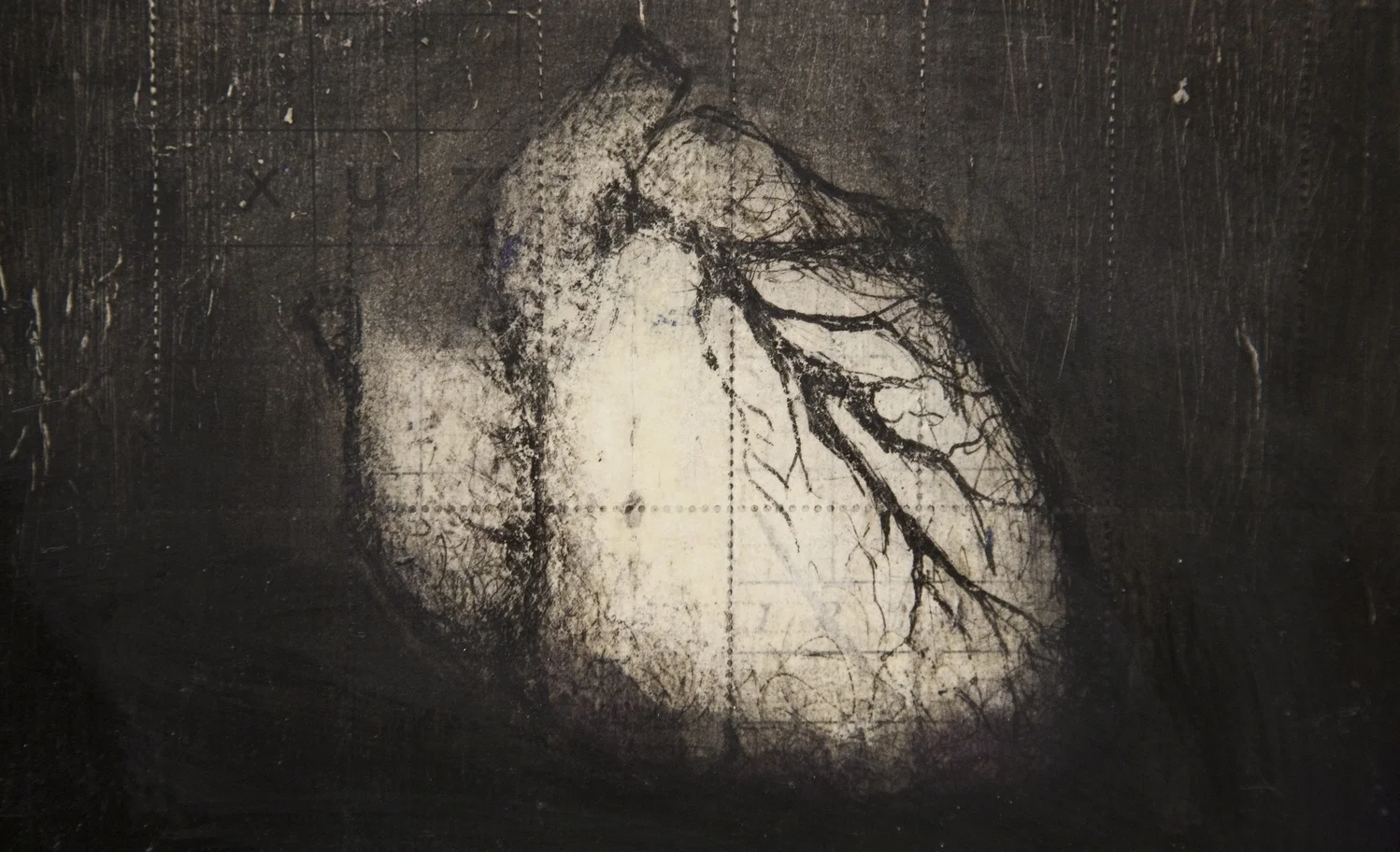 Damaged Heart