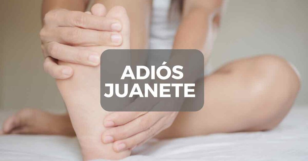 Se Puede Corregir El Juanete Sin Cirugía La Red Hispana