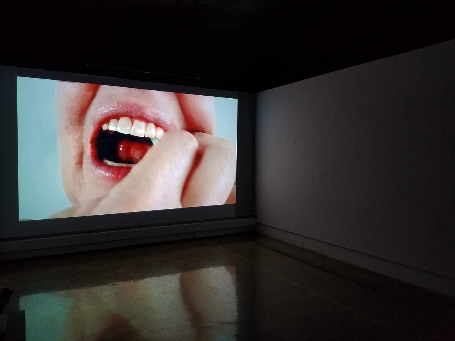 artery-2.jpg