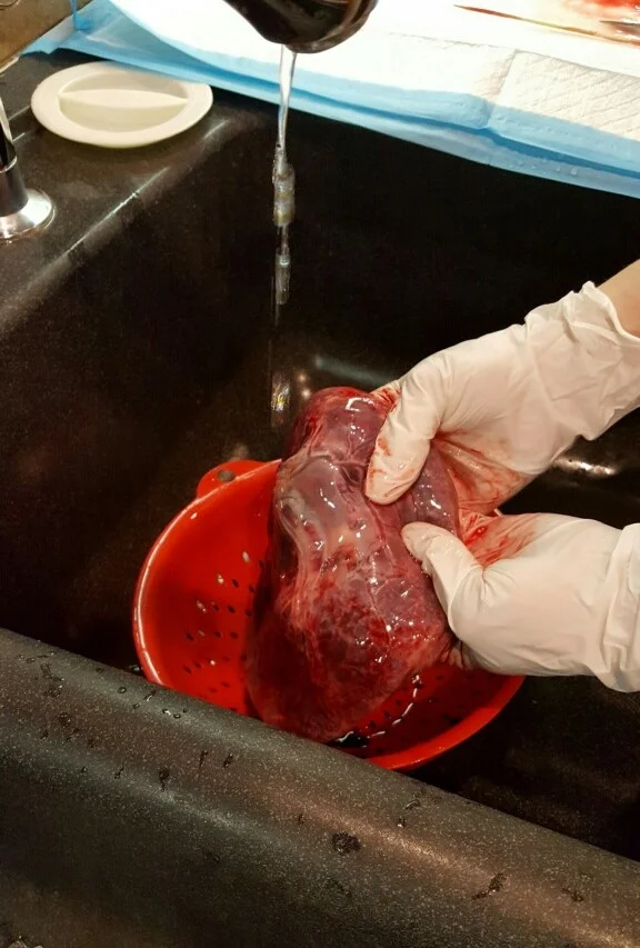 Rinsing the placenta in water.