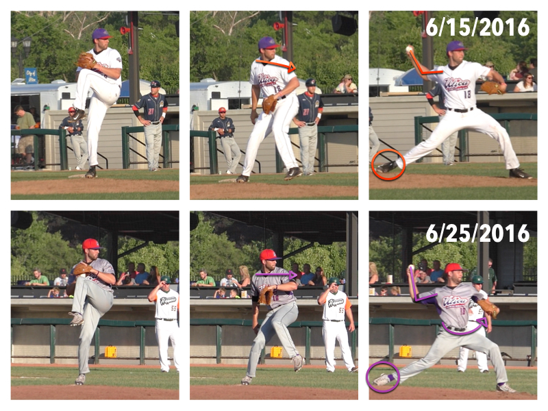 Image 1 : As a product of the DVS System and creating better timing in his delivery, Ezell placed less stress on his throwing arm and was able to maintain greater functionality and therefore greater range of motion in his throwing shoulder 24 hours after a game.