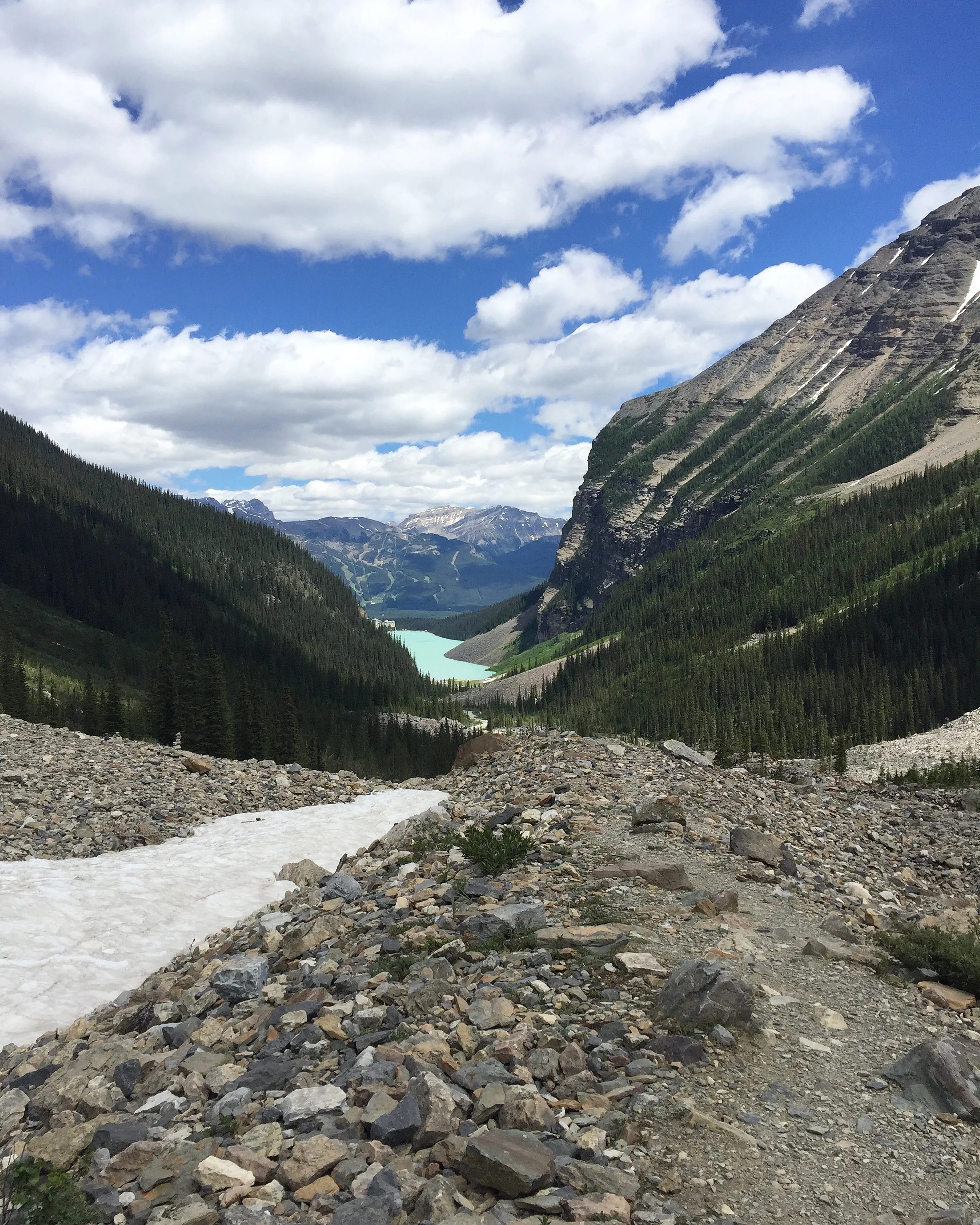 How Contact Lenses Changed My View of Life (Literally & Metaphorically)