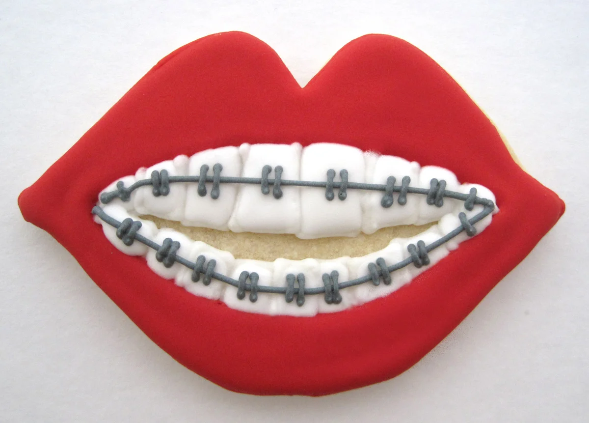 Big Mouth Braces Cookie