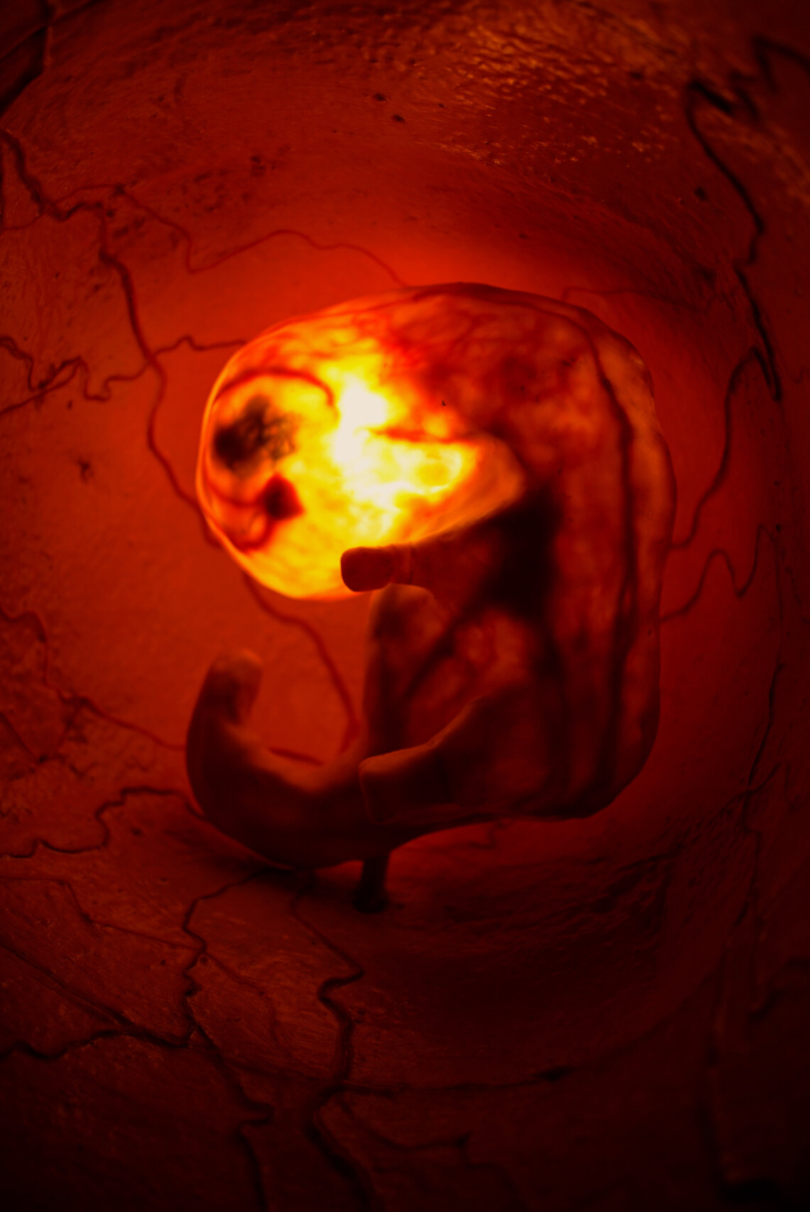 Fetal Gestation 6, Stage IV- Embryo copy.jpg